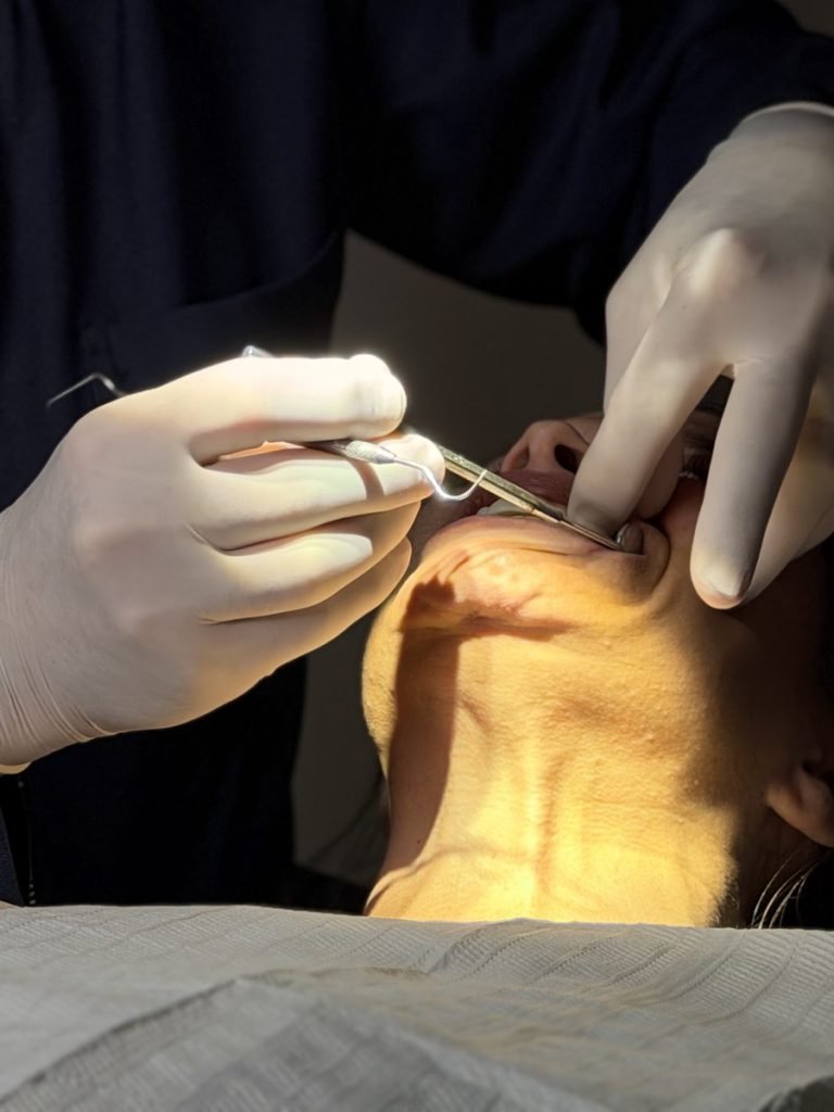 Mãos com luvas e instrumentos durante procedimento de implante